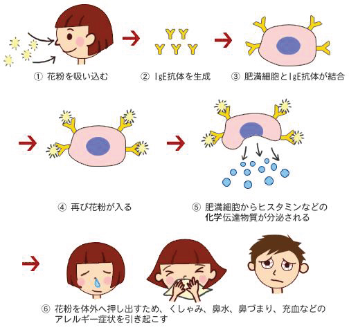 花粉症のメカニズム